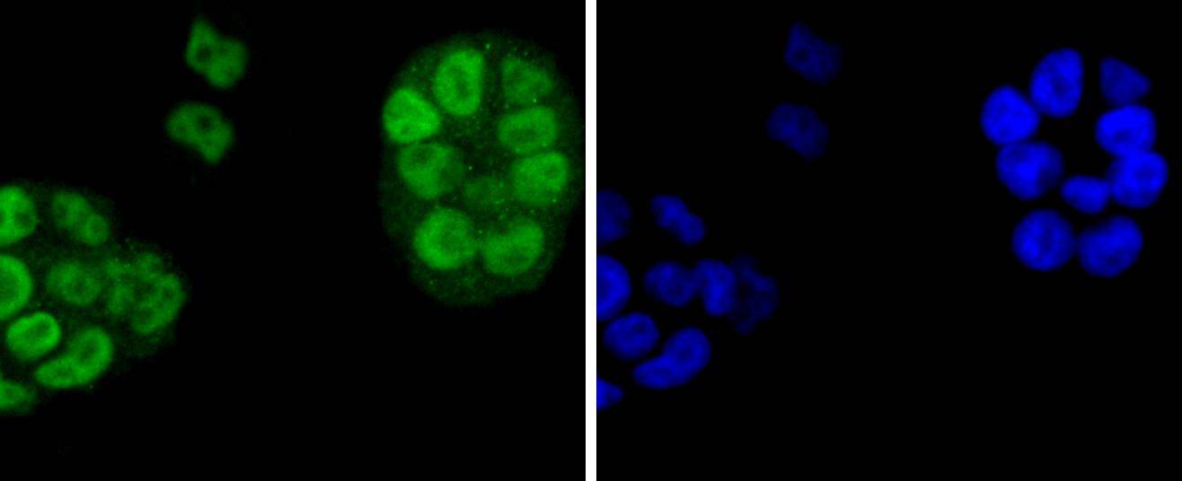 Fig4: ICC staining EIF2C3 in NCCIT cells (green). The nuclear counter stain is DAPI (blue). Cells were fixed in paraformaldehyde, permeabilised with 0.25% Triton X100/PBS.