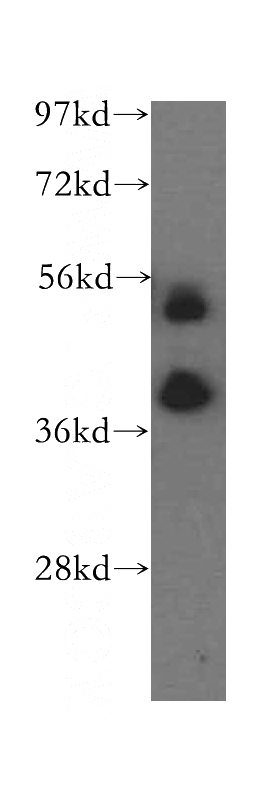 human kidney tissue were subjected to SDS PAGE followed by western blot with Catalog No:108309(ATP6V1C2 antibody) at dilution of 1:500