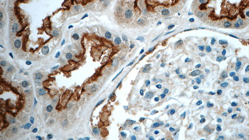 Immunohistochemistry of paraffin-embedded human kidney tissue slide using Catalog No:116187(TMEM38B Antibody) at dilution of 1:50 (under 40x lens)