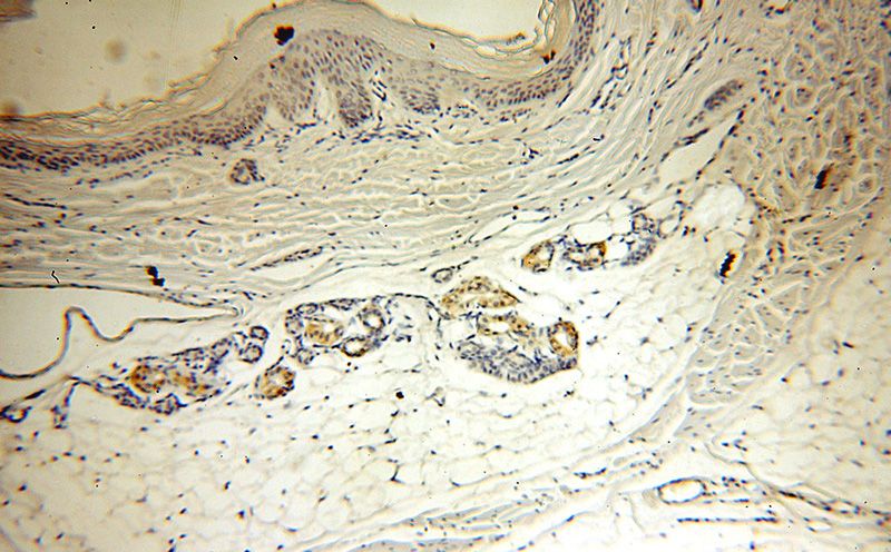 Immunohistochemical of paraffin-embedded human skin using Catalog No:109791(KRT13-Specific antibody) at dilution of 1:50 (under 10x lens)