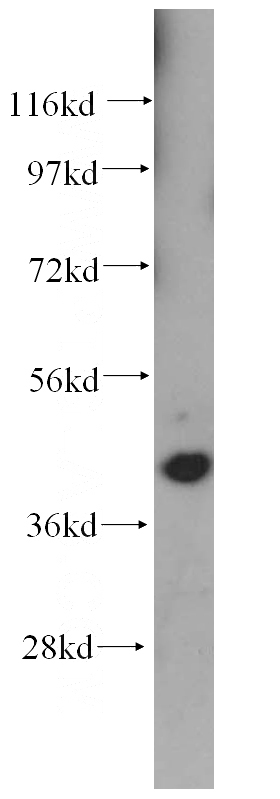 human kidney tissue were subjected to SDS PAGE followed by western blot with Catalog No:110123(DUSP9 antibody) at dilution of 1:500