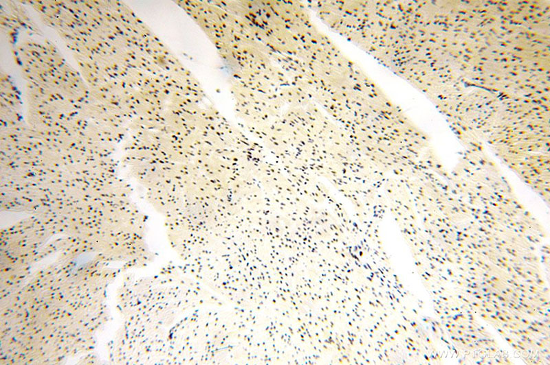 Immunohistochemical of paraffin-embedded human heart using Catalog No:111237(GTF2IRD1 antibody) at dilution of 1:100 (under 10x lens)