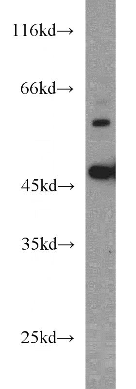 HEK-293 cells were subjected to SDS PAGE followed by western blot with Catalog No:117086(B3GALNT2 antibody) at dilution of 1:500
