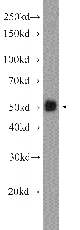 human plasma tissue were subjected to SDS PAGE followed by western blot with Catalog No:108053(AGT antibody) at dilution of 1:1000