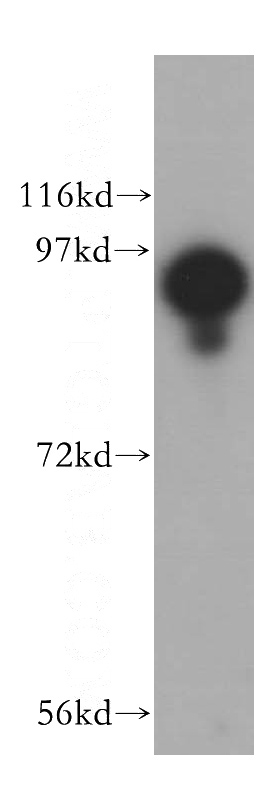 mouse lung tissue were subjected to SDS PAGE followed by western blot with Catalog No:116688(USP5 antibody) at dilution of 1:400