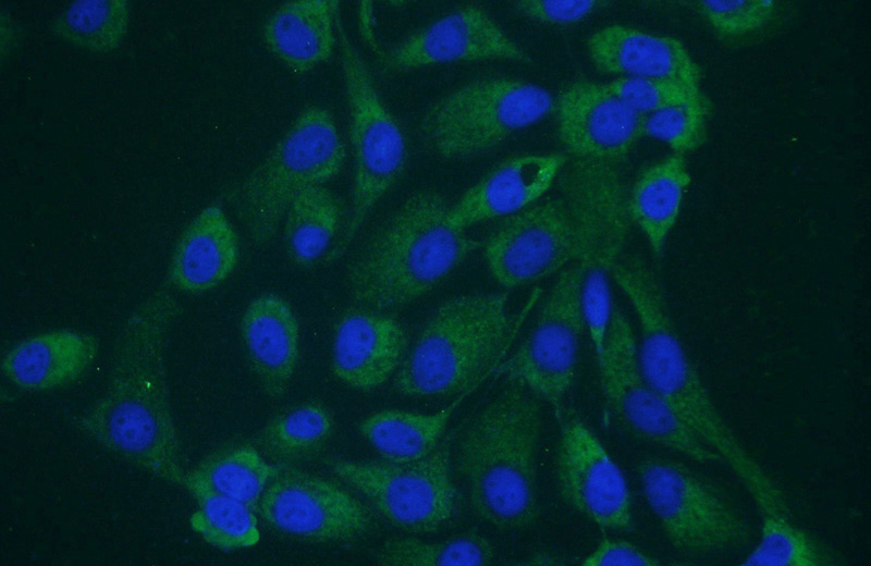 Immunofluorescent analysis of A431 cells using Catalog No:115608(SSH3 Antibody) at dilution of 1:25 and Alexa Fluor 488-congugated AffiniPure Goat Anti-Rabbit IgG(H+L)