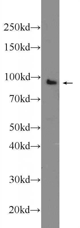 K-562 cells were subjected to SDS PAGE followed by western blot with Catalog No:116387(TTC7A Antibody) at dilution of 1:300
