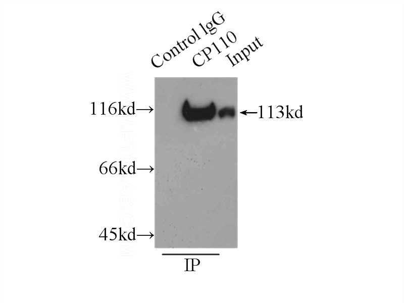 IP Result of anti-CP110 (IP:Catalog No:109504, 3ug; Detection:Catalog No:109504 1:1000) with HeLa cells lysate 3000ug.