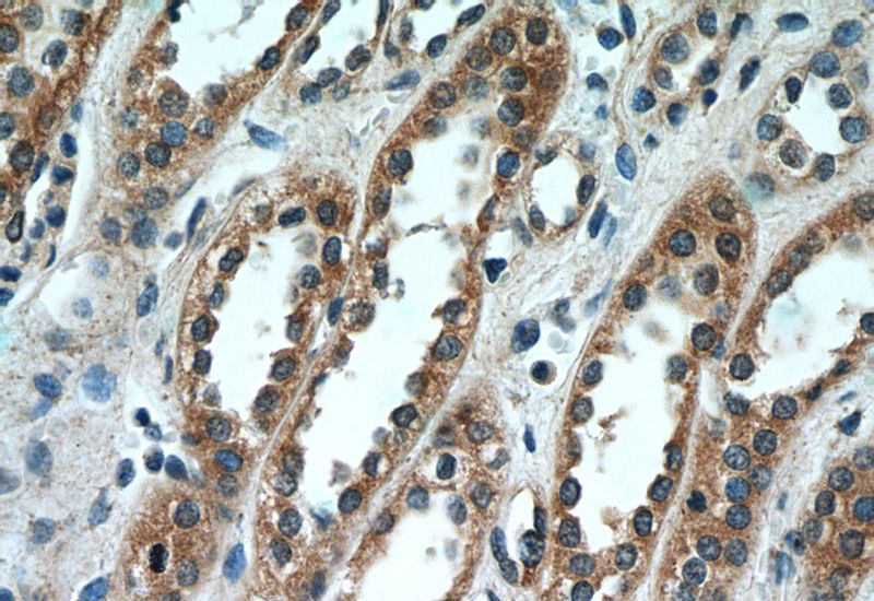 Immunohistochemistry of paraffin-embedded human kidney tissue slide using Catalog No:115010(SCNN1A Antibody) at dilution of 1:50 (under 40x lens)