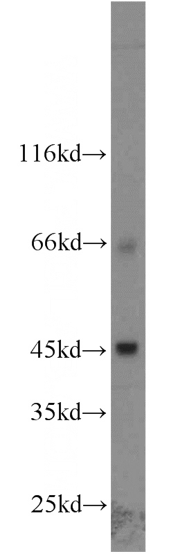 A549 cells were subjected to SDS PAGE followed by western blot with Catalog No:115369(SLC36A4 antibody) at dilution of 1:1000