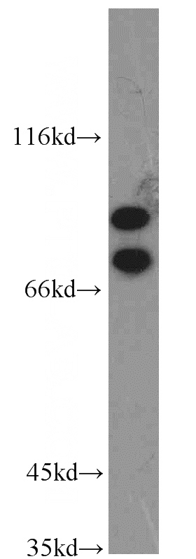 HEK-293 cells were subjected to SDS PAGE followed by western blot with Catalog No:112151(LAS1L antibody) at dilution of 1:1000