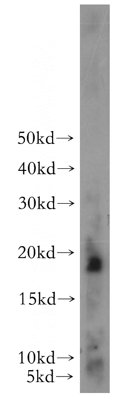 human stomach tissue were subjected to SDS PAGE followed by western blot with Catalog No:116011(TFF2 antibody) at dilution of 1:100