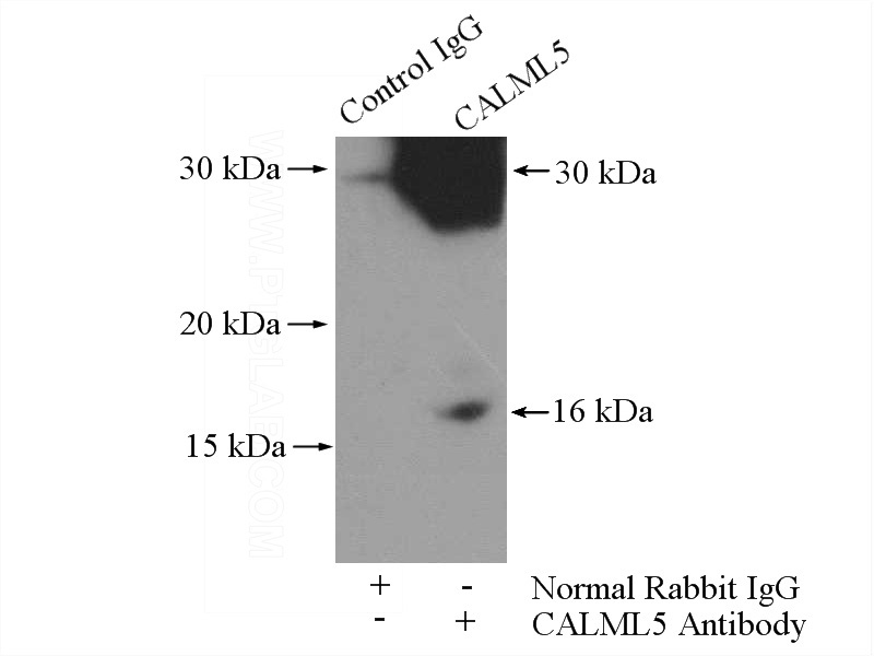 IP Result of anti-CALML5 (IP:Catalog No:108828, 3ug; Detection:Catalog No:108828 1:300) with A431 cells lysate 1600ug.