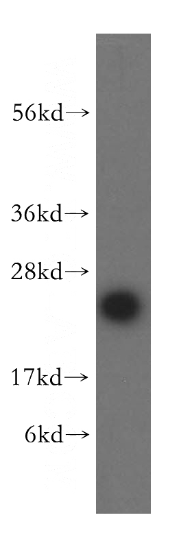 mouse liver tissue were subjected to SDS PAGE followed by western blot with Catalog No:112819(MRPL24 antibody) at dilution of 1:500