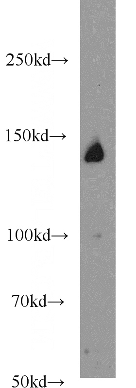 K-562 cells were subjected to SDS PAGE followed by western blot with Catalog No:113718(PERK antibody) at dilution of 1:1000