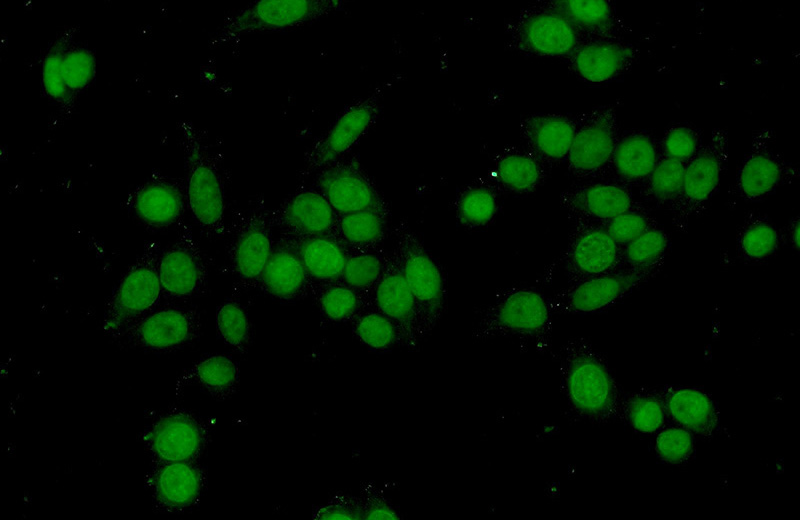 Immunofluorescent analysis of HeLa cells using Catalog No:108105(ANP32B Antibody) at dilution of 1:50 and Alexa Fluor 488-congugated AffiniPure Goat Anti-Rabbit IgG(H+L)