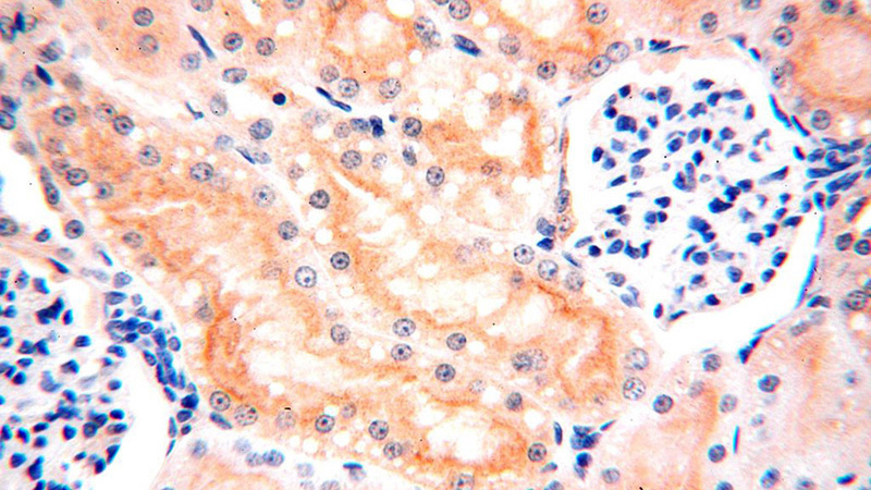 Immunohistochemical of paraffin-embedded human kidney using Catalog No:108303(ATP6V0D1 antibody) at dilution of 1:100 (under 40x lens)