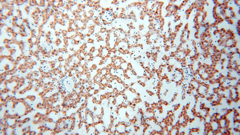 Immunohistochemical of paraffin-embedded human liver using Catalog No:111483(HMGCL antibody) at dilution of 1:100 (under 10x lens)