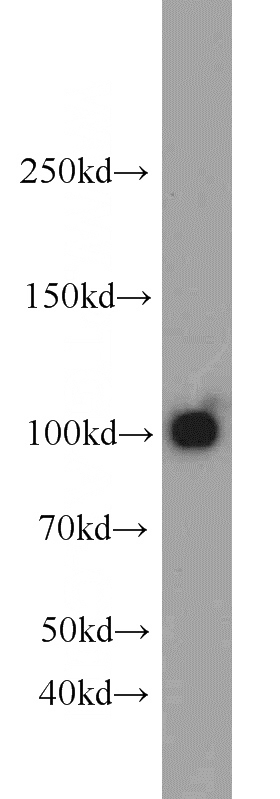 mouse brain tissue were subjected to SDS PAGE followed by western blot with Catalog No:111080(GRIA2 antibody) at dilution of 1:1000