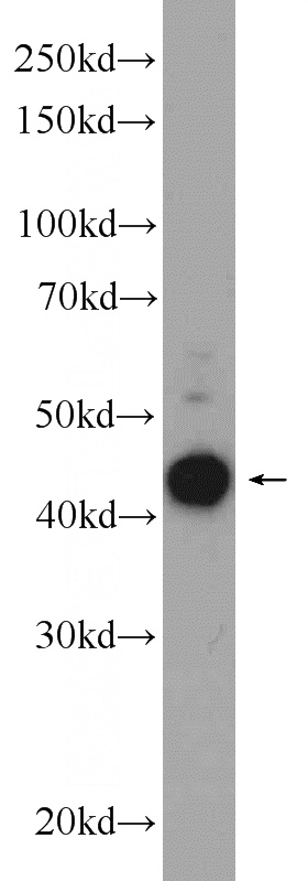 A431 cells were subjected to SDS PAGE followed by western blot with Catalog No:112405(LYAR Antibody) at dilution of 1:1000