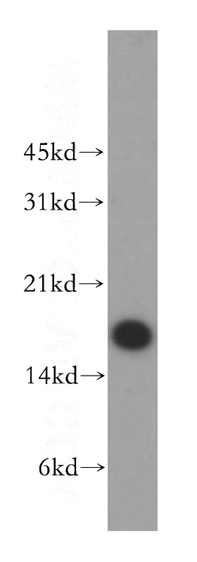 A431 cells were subjected to SDS PAGE followed by western blot with Catalog No:108828(CALML5 antibody) at dilution of 1:400