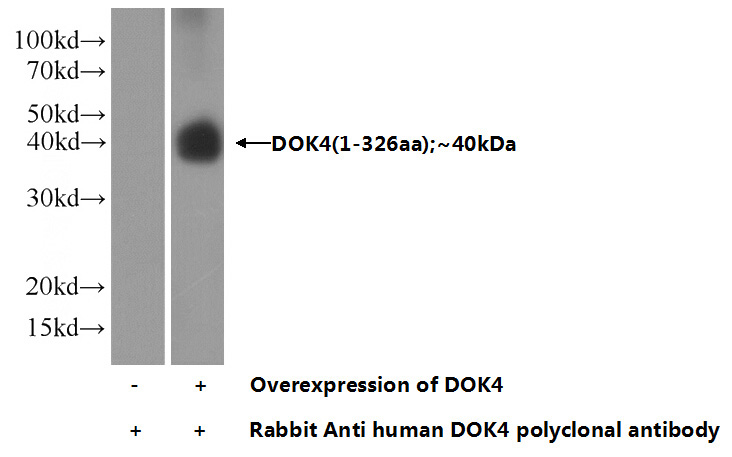 Transfected HEK-293 cells were subjected to SDS PAGE followed by western blot with Catalog No:110052(DOK4 Antibody) at dilution of 1:2000