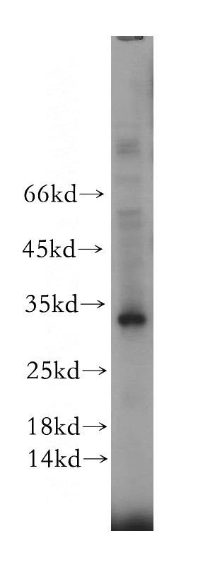 HEK-293 cells were subjected to SDS PAGE followed by western blot with Catalog No:114866(RTP1 antibody) at dilution of 1:300