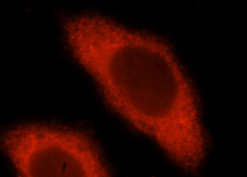 Immunofluorescent analysis of Hela cells, using VTA1 antibody Catalog No:116805 at 1:25 dilution and Rhodamine-labeled goat anti-rabbit IgG (red).