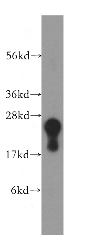 human brain tissue were subjected to SDS PAGE followed by western blot with Catalog No:110031(DTD1 antibody) at dilution of 1:500