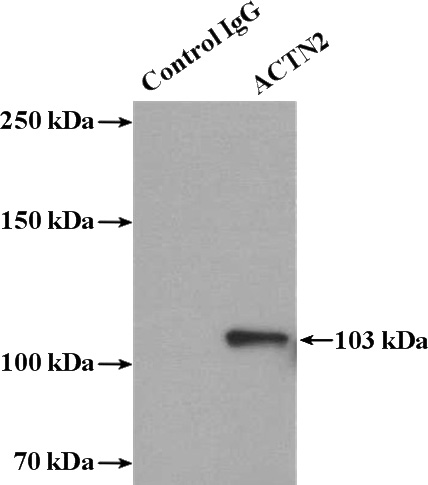 IP Result of anti-ACTN2 (IP:Catalog No:107710, 4ug; Detection:Catalog No:107710 1:1000) with HeLa cells lysate 1080ug.
