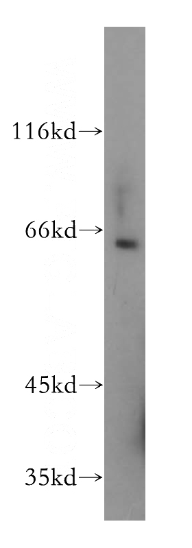 mouse kidney tissue were subjected to SDS PAGE followed by western blot with Catalog No:110721(FZD10 antibody) at dilution of 1:800