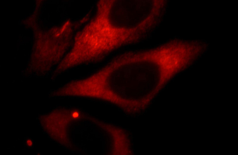Immunofluorescent analysis of HepG2 cells, using KNG1 antibody Catalog No:112057 at 1:25 dilution and Rhodamine-labeled goat anti-rabbit IgG (red).