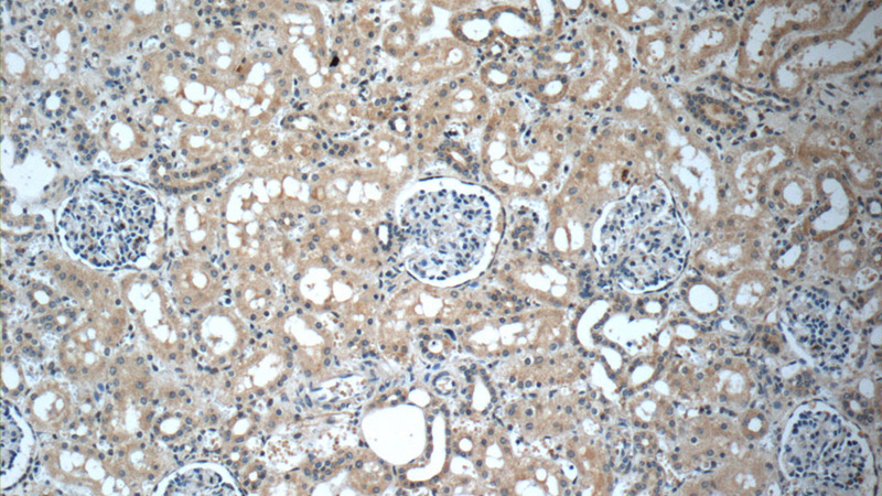 Immunohistochemistry of paraffin-embedded human kidney slide using Catalog No:116930(ZC3HAV1L Antibody) at dilution of 1:50