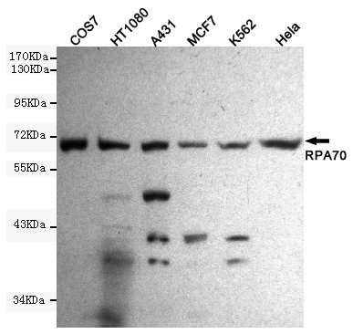 Western blot detection of RPA70 in Hela,A431,MCF7,COS7,HT1080 and K562 cell lysates using RPA70 mouse mAb (1:1000 diluted).Predicted band size:70KDa.Observed band size:70KDa.