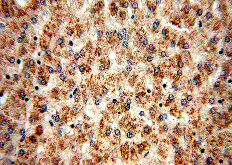 Immunohistochemical of paraffin-embedded human liver using Catalog No:108377(BBS9 antibody) at dilution of 1:50 (under 40x lens)