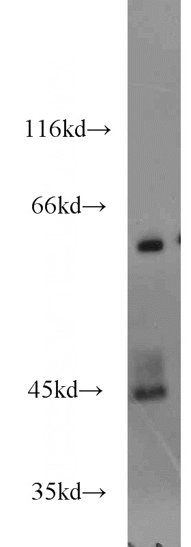 Jurkat cells were subjected to SDS PAGE followed by western blot with Catalog No:113632(PDLIM7 antibody) at dilution of 1:1500