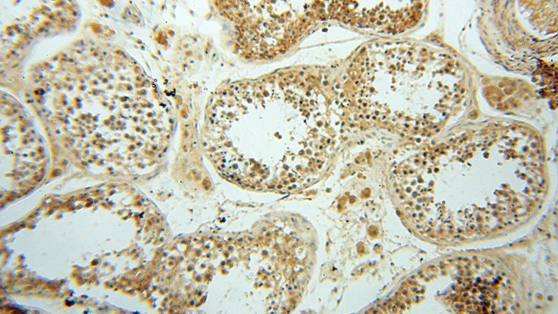 Immunohistochemical of paraffin-embedded human testis using Catalog No:112344(LSG1 antibody) at dilution of 1:50 (under 10x lens)