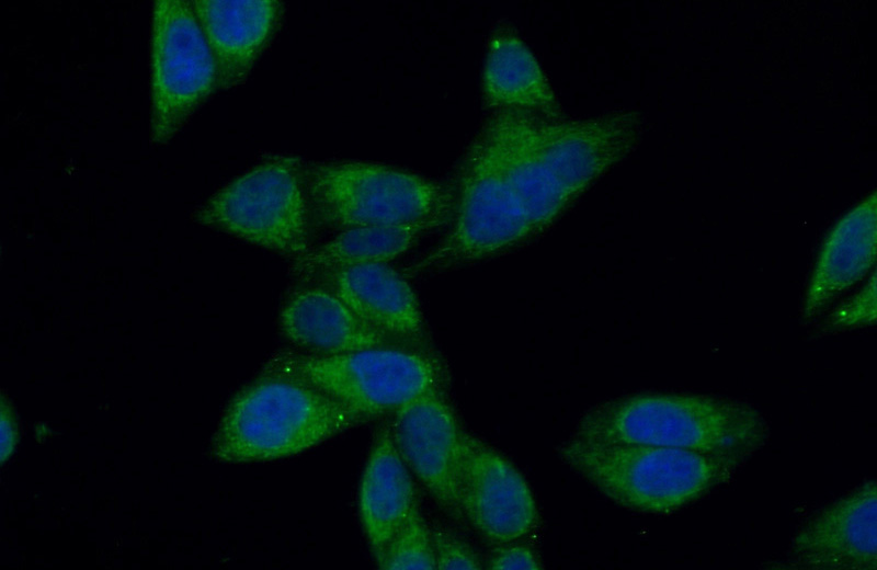 Immunofluorescent analysis of (10% Formaldehyde) fixed HepG2 cells using Catalog No:113209(NPC1 Antibody) at dilution of 1:50 and Alexa Fluor 488-congugated AffiniPure Goat Anti-Rabbit IgG(H+L)