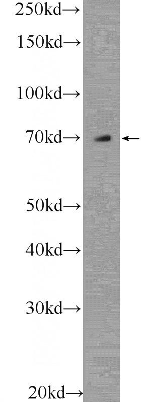 A549 cells were subjected to SDS PAGE followed by western blot with Catalog No:115112(SEPN1 Antibody) at dilution of 1:300