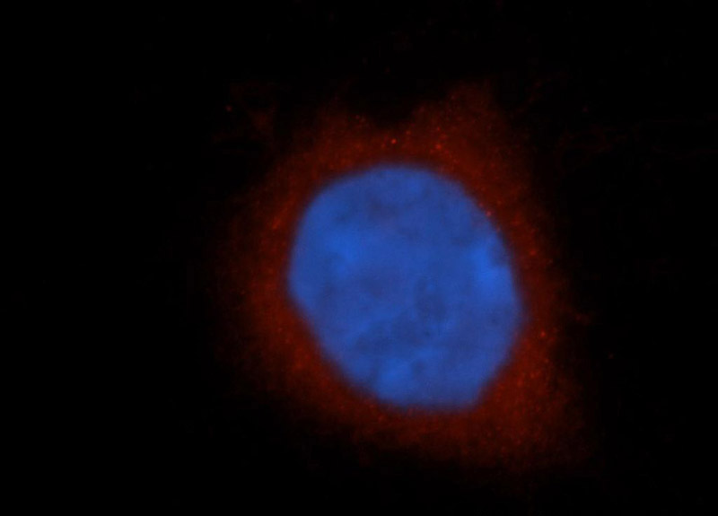 Immunofluorescent analysis of Hela cells, using KCNAB1 antibody Catalog No:111924 at 1:50 dilution and Rhodamine-labeled goat anti-rabbit IgG (red). Blue pseudocolor = DAPI (fluorescent DNA dye).
