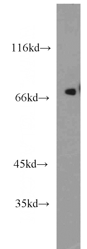 mouse heart tissue were subjected to SDS PAGE followed by western blot with Catalog No:111924(KCNAB1 antibody) at dilution of 1:1500