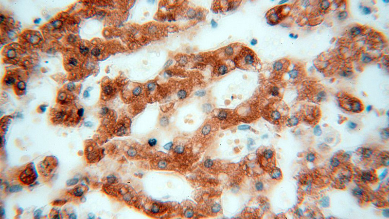 Immunohistochemical of paraffin-embedded human liver using Catalog No:109192(CES1 antibody) at dilution of 1:200 (under 40x lens)
