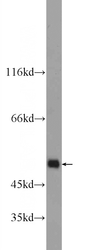 NIH/3T3 cells were subjected to SDS PAGE followed by western blot with Catalog No:112027(KDM4A Antibody) at dilution of 1:300