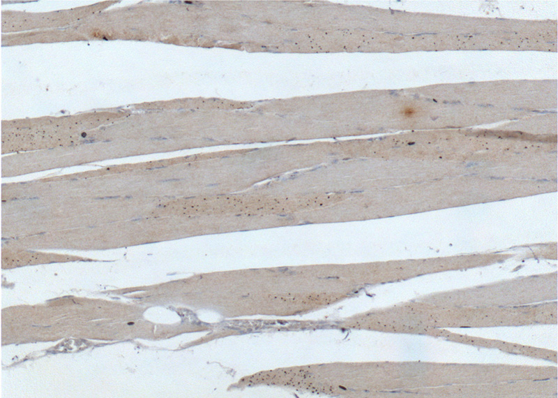 Immunohistochemistry of paraffin-embedded human skeletal muscle tissue slide using Catalog No:108301(ATP6 Antibody) at dilution of 1:200 (under 10x lens).
