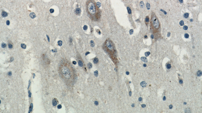 Immunohistochemical of paraffin-embedded human brain using Catalog No:112046(KIAA0319L antibody) at dilution of 1:100 (under 40x lens)