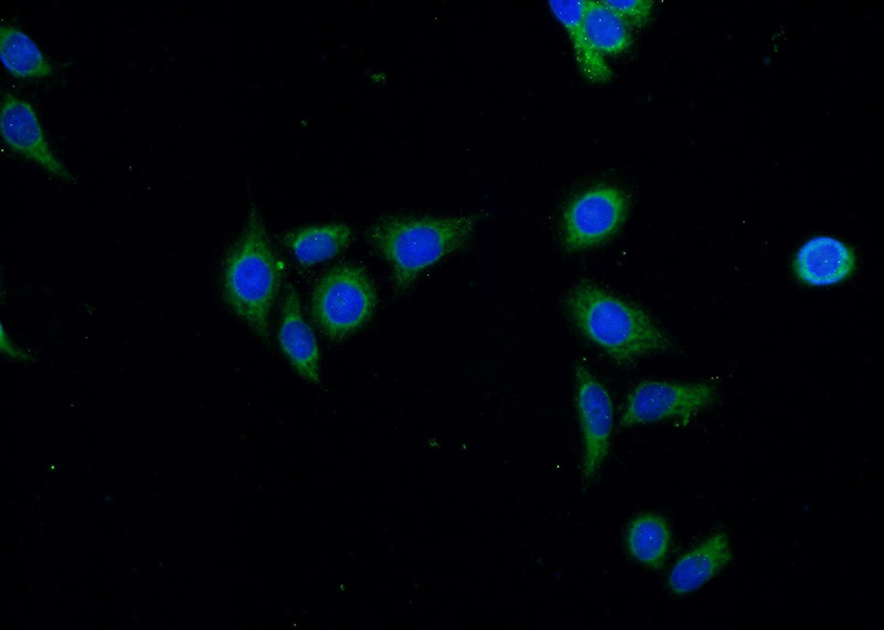 Immunofluorescent analysis of (-20oc Ethanol) fixed HeLa cells using Catalog No:113902(PIK3C2B Antibody) at dilution of 1:25 and Alexa Fluor 488-congugated AffiniPure Goat Anti-Rabbit IgG(H+L)