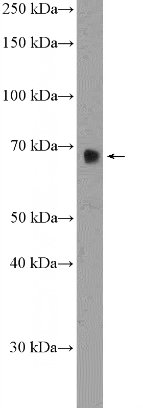 HEK-293T cells were subjected to SDS PAGE followed by western blot with Catalog No:114611(RBM39 Antibody) at dilution of 1:1000