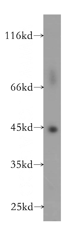 K-562 cells were subjected to SDS PAGE followed by western blot with Catalog No:111233(GTF2H2 antibody) at dilution of 1:500