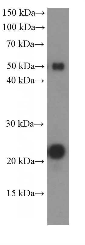 Jurkat cells were subjected to SDS PAGE followed by western blot with Catalog No:107130(CD3G Antibody) at dilution of 1:4000