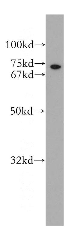 PC-3 cells were subjected to SDS PAGE followed by western blot with Catalog No:111593(ICK antibody) at dilution of 1:300